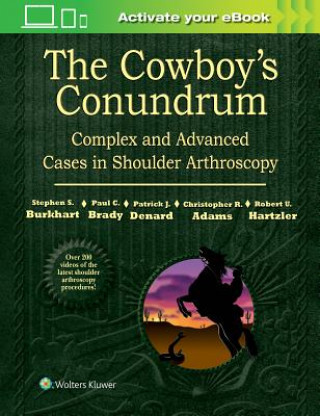 Cowboy's Conundrum: Complex and Advanced Cases in Shoulder Arthroscopy
