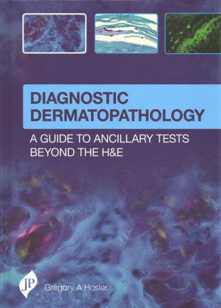 Diagnostic Dermatopathology: A Guide to Ancillary Tests Beyond the H&E