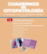 Citología ginecológica: Infecciones fúngicas. Virus del Papiloma Humano (HPV)