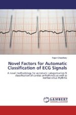 Novel Factors for Automatic Classification of ECG Signals