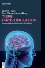 Tiefe Hirnstimulation