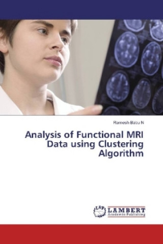 Analysis of Functional MRI Data using Clustering Algorithm