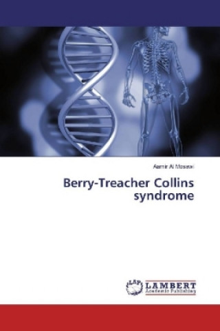 Berry-Treacher Collins syndrome