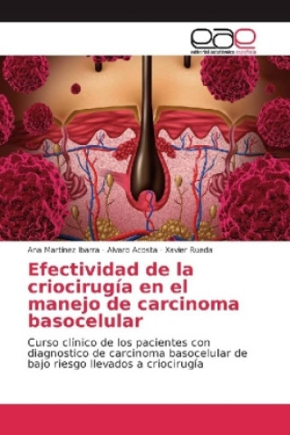 Efectividad de la criocirugía en el manejo de carcinoma basocelular