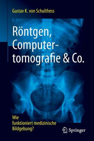 Roentgen, Computertomografie & Co.