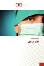 Sinus lift