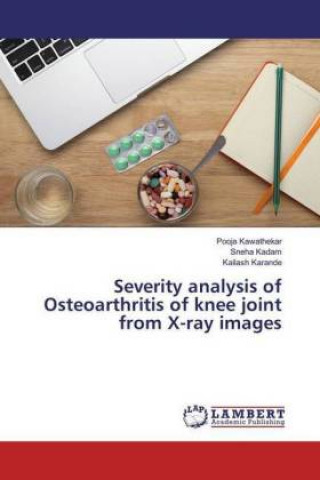 Severity analysis of Osteoarthritis of knee joint from X-ray images