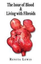 Issue Of Blood & Living with Fibroids