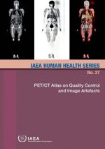 PET/CT atlas on quality control and image artefacts