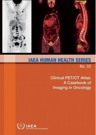 Clinical PET/CT atlas