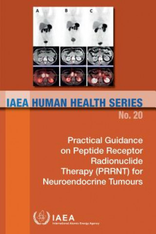 Practical guidance on peptide receptor radionuclide therapy (PRRNT) in neuroendocrine tumours