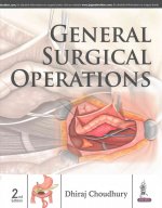 General Surgical Operations