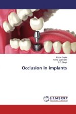 Occlusion in implants