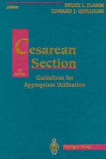 CESAREAN SECTION 1995/E