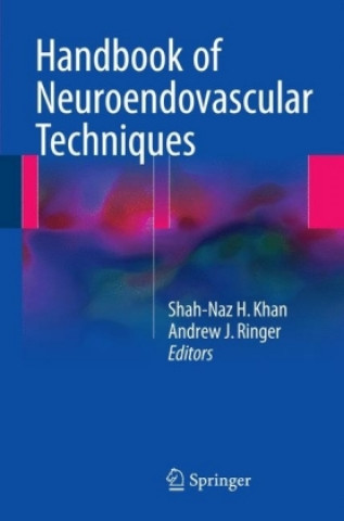 Handbook of Neuroendovascular Techniques