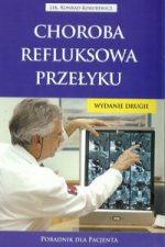 Choroba refluksowa przelyku Poradnik dla pacjenta