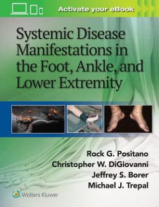 Systemic Disease Manifestations in the Foot, Ankle, and Lower Extremity