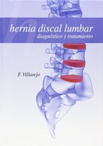 Hernia discal lumbar