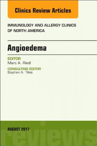 Angioedema, An Issue of Immunology and Allergy Clinics of North America