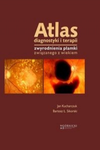 Atlas diagnostyki i terapii zwyrodnienia plamki zwiazanego z wiekiem