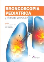 Broncoscopia pediátrica y técnicas asociadas