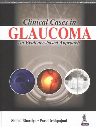 Clinical Cases in Glaucoma