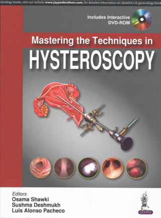 Mastering the Techniques in Hysteroscopy