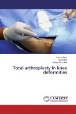 Total arthroplasty in knee deformities