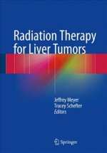 Radiation Therapy for Liver Tumors