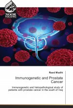 Immunogenetic and Prostate Cancer
