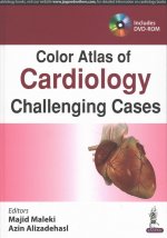Color Atlas of Cardiology