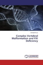 Complex Vertebral Malformation and FXI Deficiency