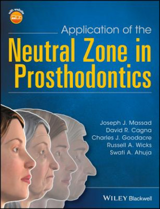 Application of the Neutral Zone in Prosthodontics