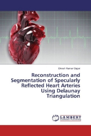 Reconstruction and Segmentation of Specularly Reflected Heart Arteries Using Delaunay Triangulation