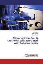 Micronuclei in Oral & Urothelial cells associated with Tobacco habits