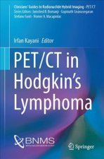 PET/CT in Hodgkin's Lymphoma