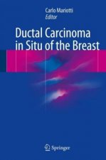 Ductal Carcinoma in Situ of the Breast