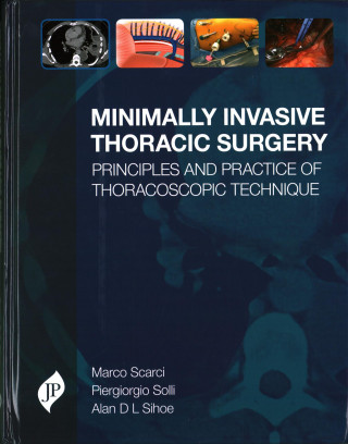 Minimally Invasive Thoracic Surgery