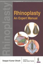 Rhinoplasty