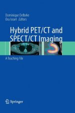 Hybrid PET/CT and SPECT/CT Imaging