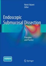 Endoscopic Submucosal Dissection