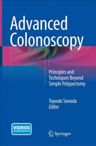 Advanced Colonoscopy