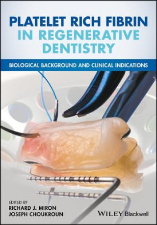Platelet Rich Fibrin in Regenerative Dentistry - Biological Background and Clinical Indications