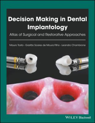 Decision Making in Dental Implantology - Atlas of Surgical and Restorative Approaches