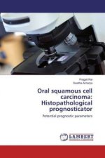 Oral squamous cell carcinoma: Histopathological prognosticator
