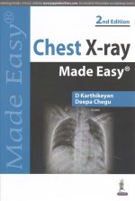 Chest X-ray Made Easy