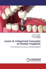 Learn & Unlearned Concepts of Dental Implants