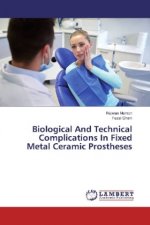 Biological And Technical Complications In Fixed Metal Ceramic Prostheses