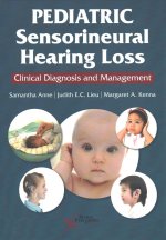 Pediatric Sensorineural Hearing Loss