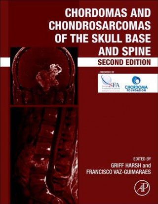 Chordomas and Chondrosarcomas of the Skull Base and Spine